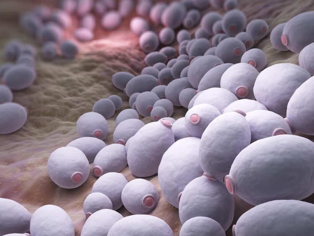 Soulager la candidose mammaire avec des remèdes naturels